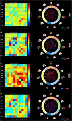 Abnormal dynamic functional network connectivity in patients with early-onset bipolar disorder